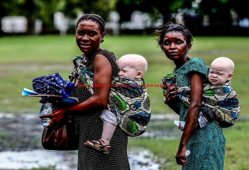 Tanzania's albino children ....