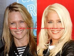 ... Separate dalla nascita .....